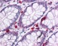 PIAS1 Antibody (C-Terminus)